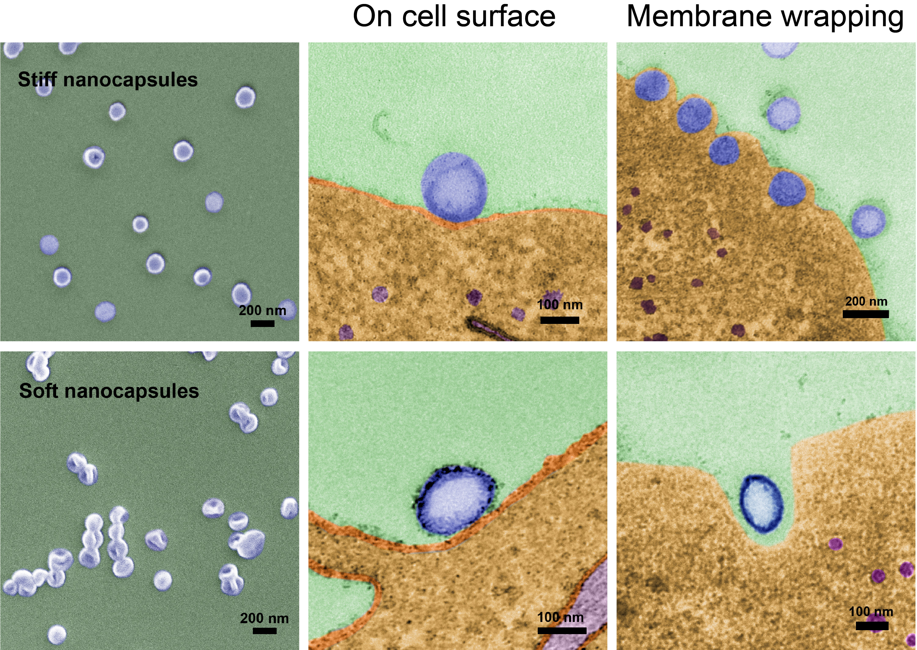 Hard nanoparticles can enter cancer cells better than ‘squishy’ ones 