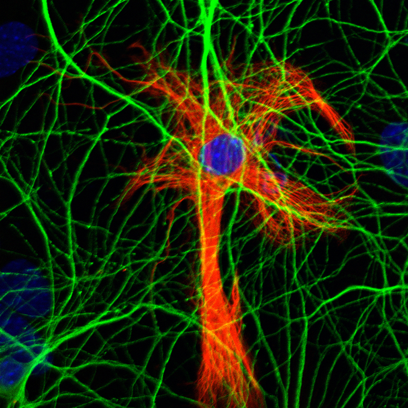 Close-up of organoids used for Alzheimer's research.