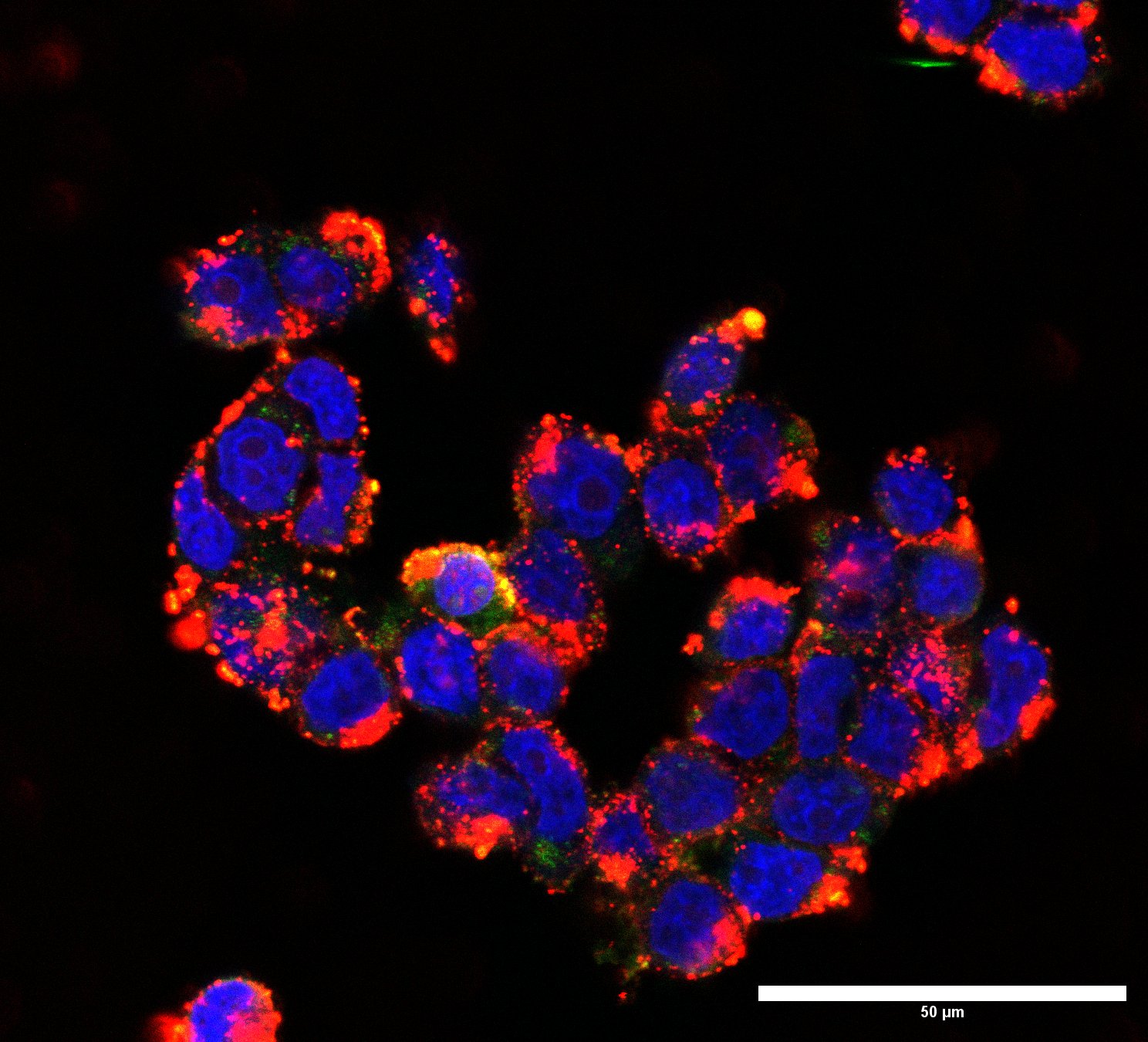 Here we can see the medulloblastoma cells following nanoparticle delivery of AF647 siRNA. The cells nuclei are shown in blue and the abundance of siRNA in the cytoplasm of cells is shown in red.
