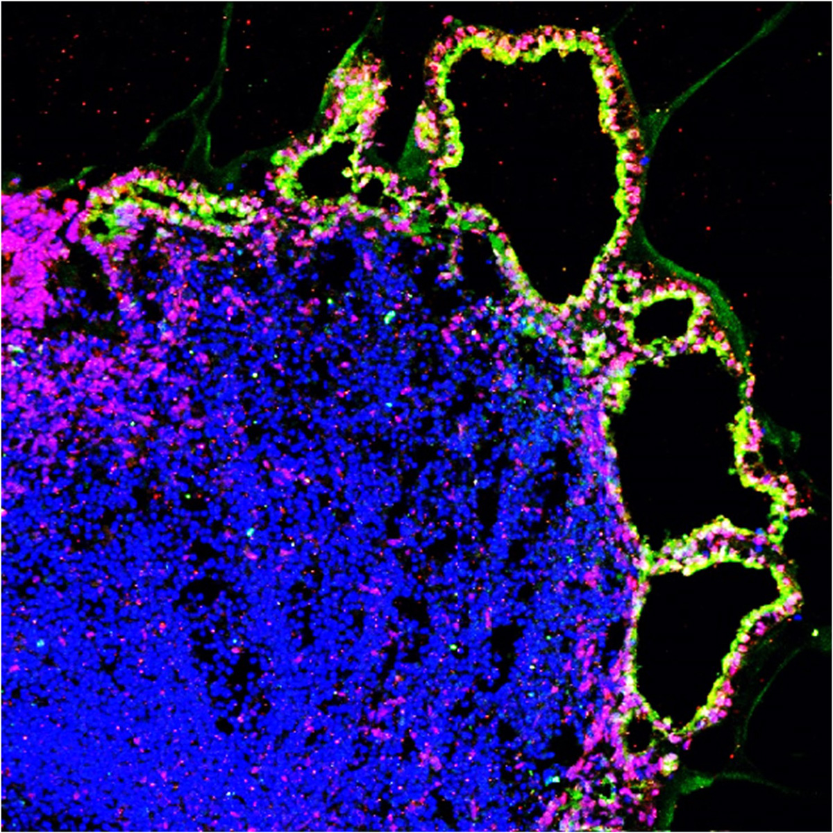 The AIBN team grew Down syndrome brain models and encased them in a layer of specialised cells known as the choroid plexus, effectively creating an organoid with two functional brain domains for the first time.