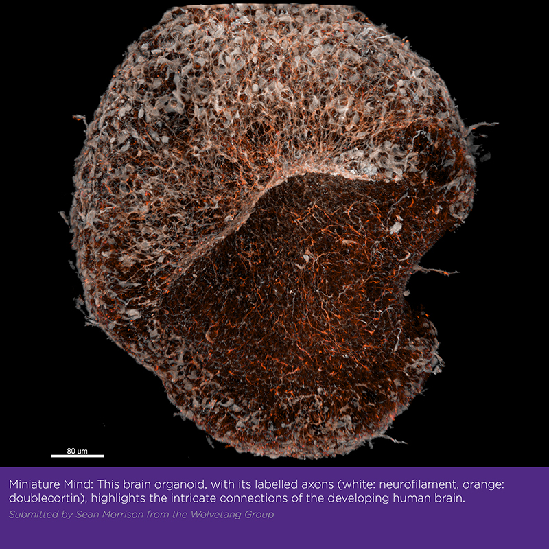 Brain organoid