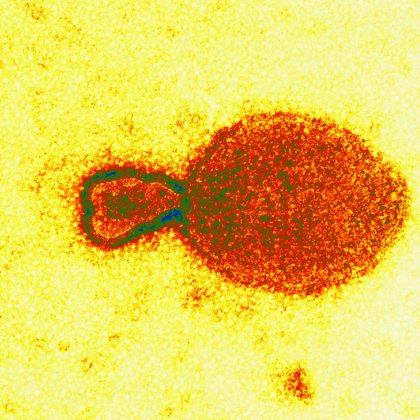 A coloured transmission electron micrograph of the Hendra virus. Image produced by Electron Microscopy Unit, Australian Animal Health Laboratory