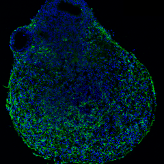 day 45 organoids stained with DAPI (blue) and MAP2 (green). 