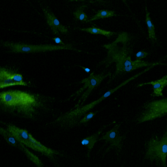 MSCs under the microscope (blue: DAPI; green: beta-gal)