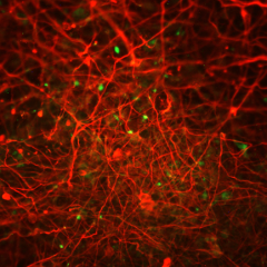 Processed aggregated amyloid