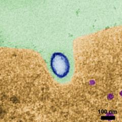 Hard nanoparticles can enter cancer cells better than ‘squishy’ ones 
