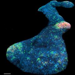 AIBN researchers created organoids – human mini-spinal cords in a dish – that closely mimic the spinal cord of a fetus in the early weeks of gestation.