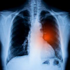 AIBN researchers ​​​​​​​Dr Richard Lobb and Quan Zhou are working on technology that reads sugar molecules to detect the early signs of lung cancer. 