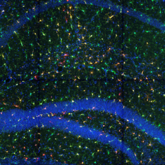 Microglia in the Dentate Gyrus