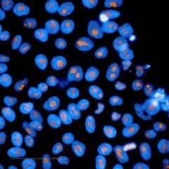Modeling ageing with iPSCs. Proliferating iPSCs from a patient with DNA repair mechanism impairments.